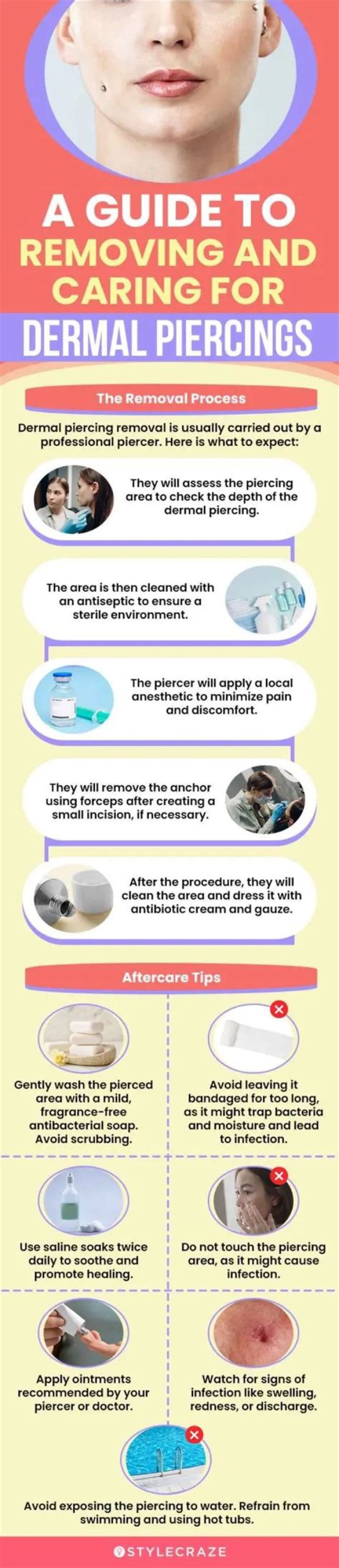 Can a dermal piercing be removed?