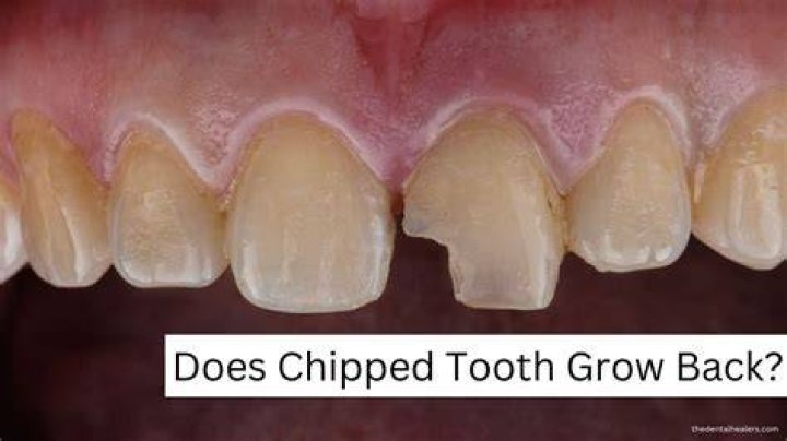 Can chipped teeth grow back?