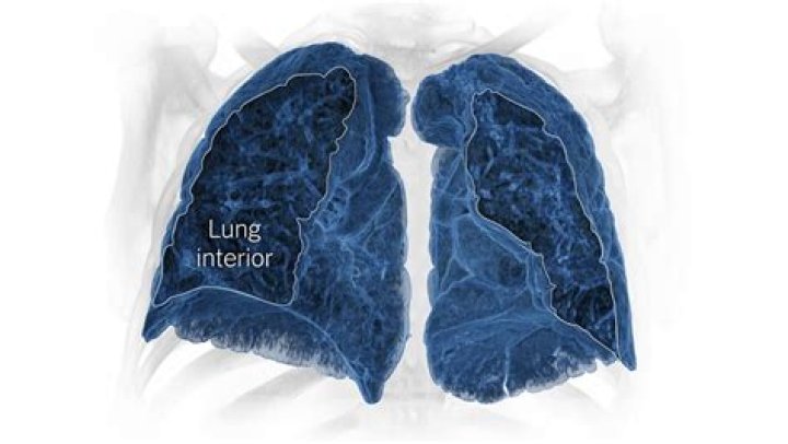 Can fiberglass cause lung disease?