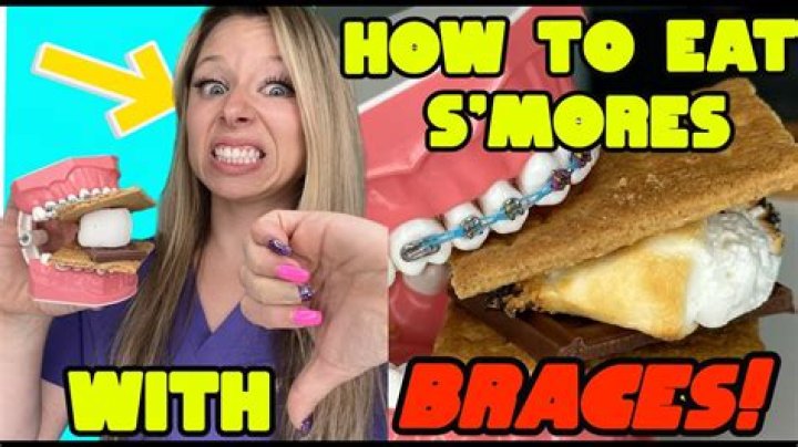 Can I eat M&Ms with braces?