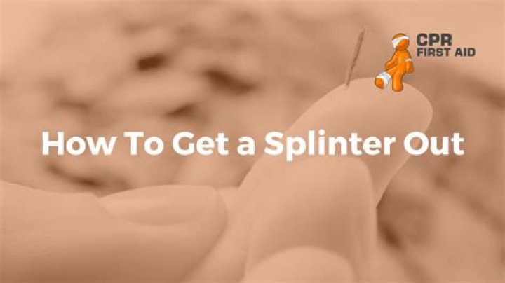 Can I soak a splinter out?
