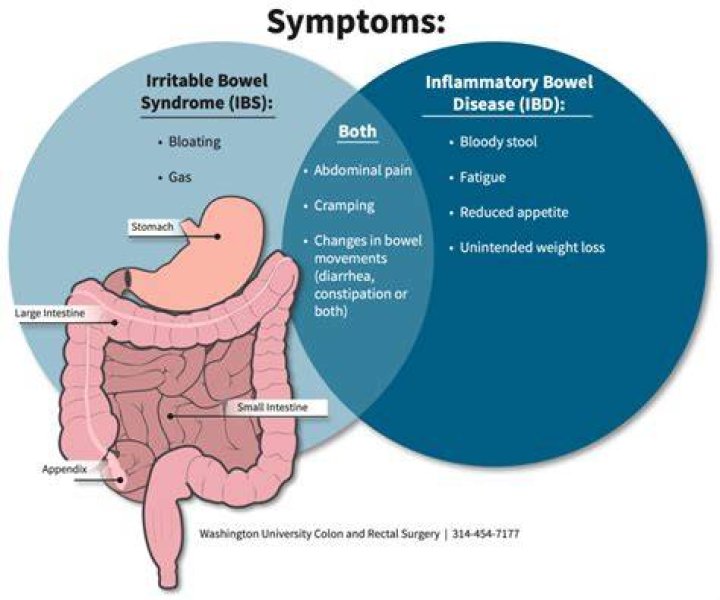 Can IBS cause stomach noises?