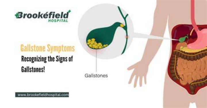 Can not drinking enough water cause gallstones?