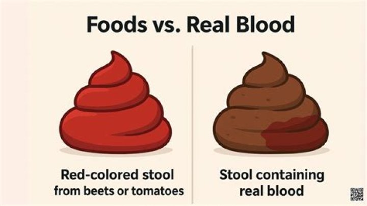 Can spicy food cause bloody stool?