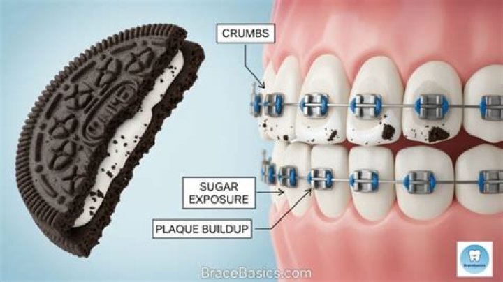 Can you eat Oreos with braces?