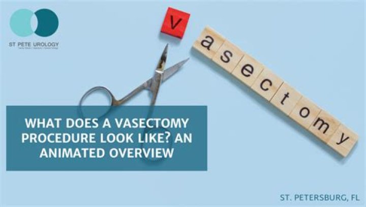 Can you feel your vasectomy clips?