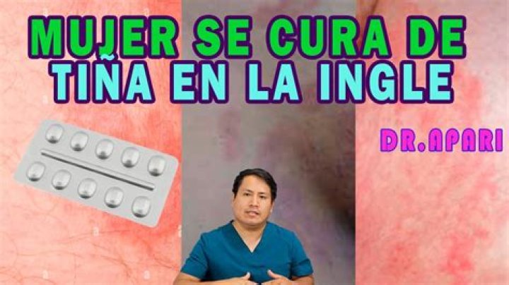 ¿Cómo eliminar la tina inguinal rápido?