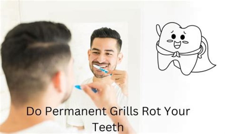 Do permanent grills rot your teeth?