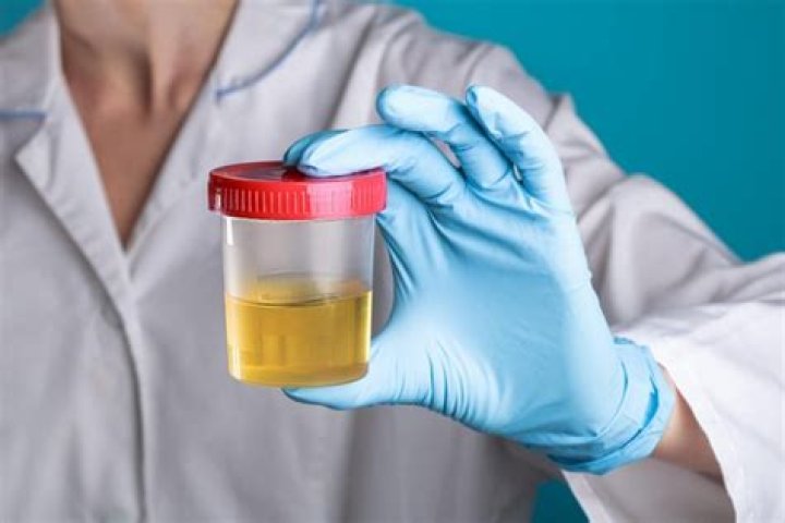 Do sprouts drug test?
