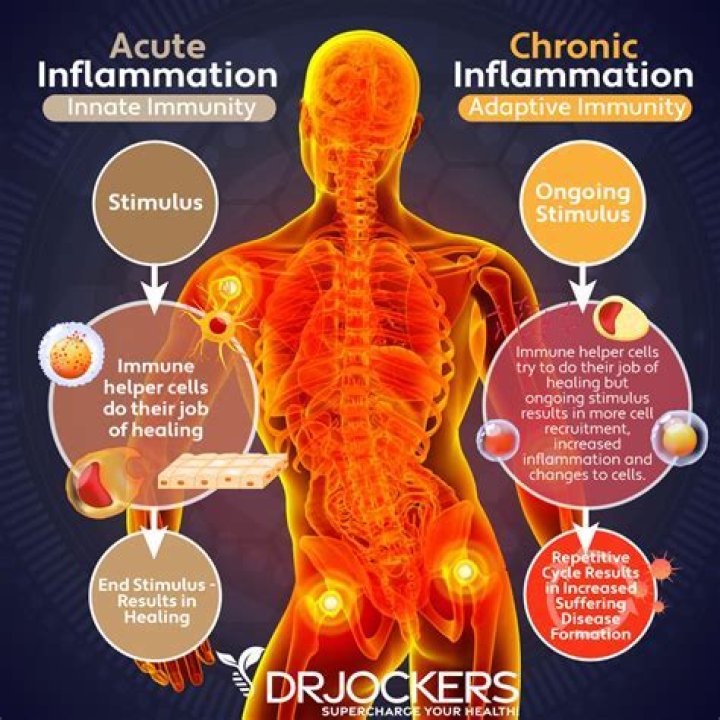 Do sulfites cause inflammation?