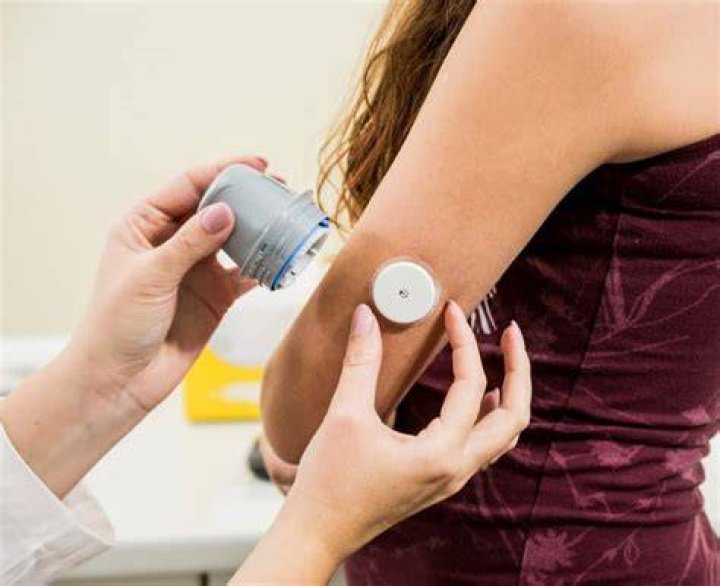 Do you need a prescription for glucose monitor?