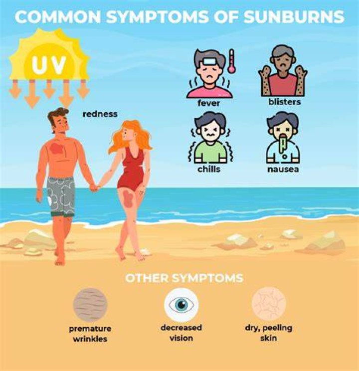 Does a hot shower take the heat out of a sunburn?