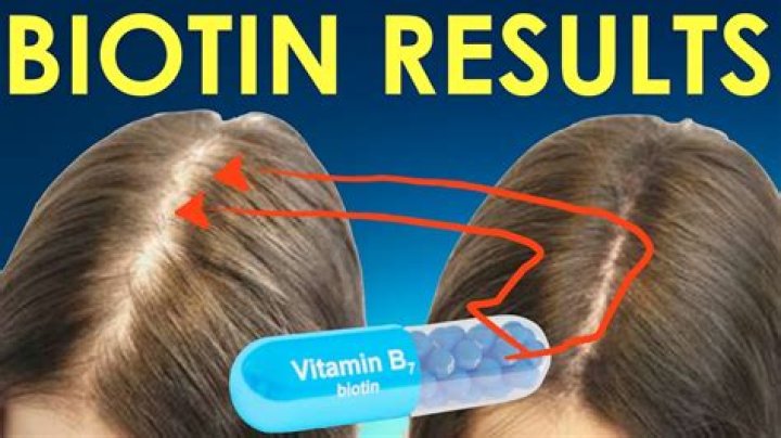 Does biotin help hair growth?