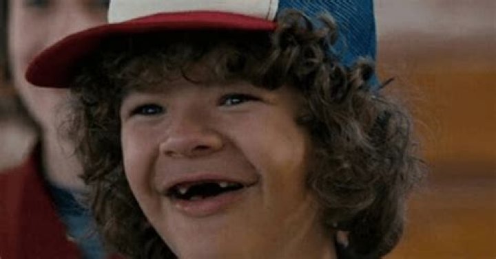 Does Dustin have teeth in real life?