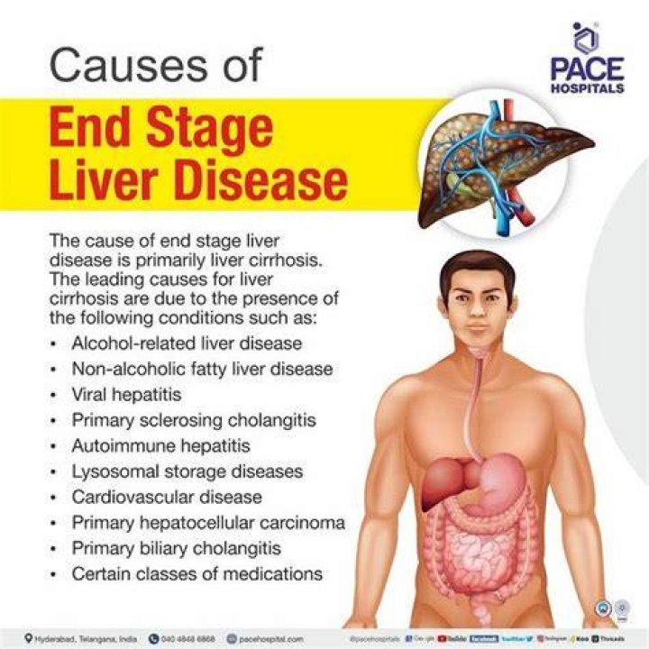 Does EGCG cause liver damage?