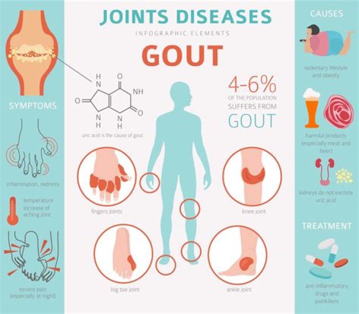 Does gout pain move from joint to joint?