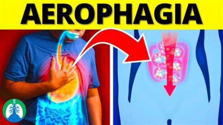 How do I get rid of Aerophagia?