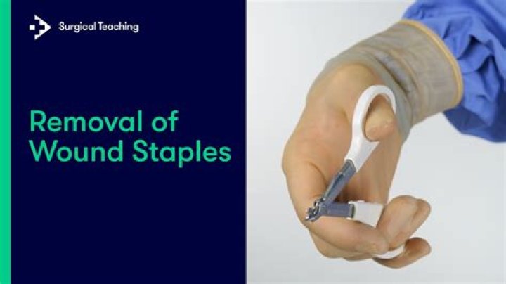 How do vets remove staples?