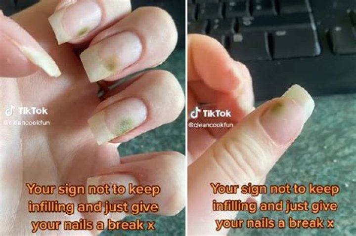 How do you get liquid nails off your skin?