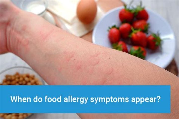 How do you know if you’re allergic to soda?