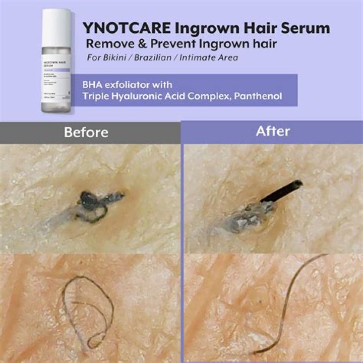 How do you remove hair from a blade?