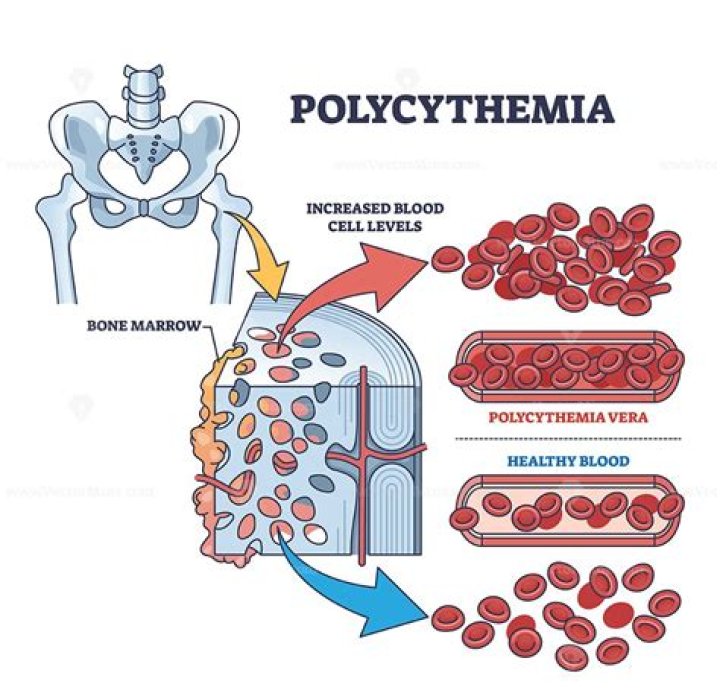 How is polycythemia treated in dogs?