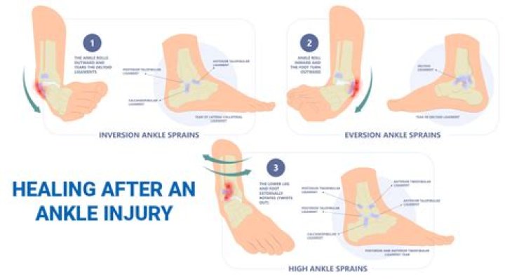 How long does it take for a sprained ankle to heal?