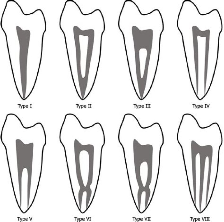 How rare is a tooth with three roots?