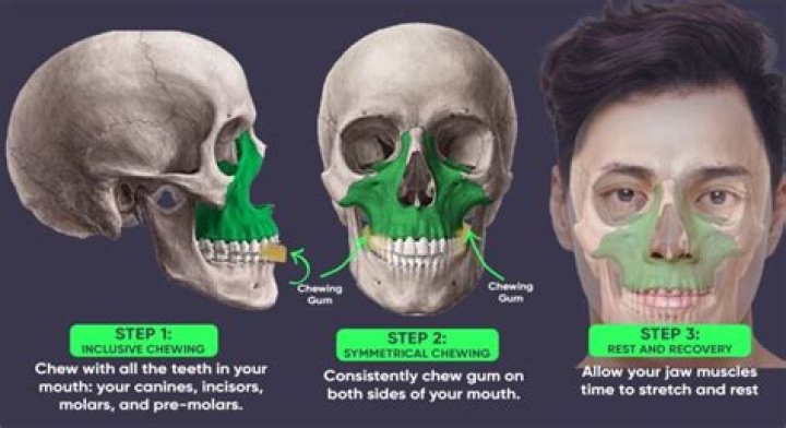 Is chewing gum good for your jawline?