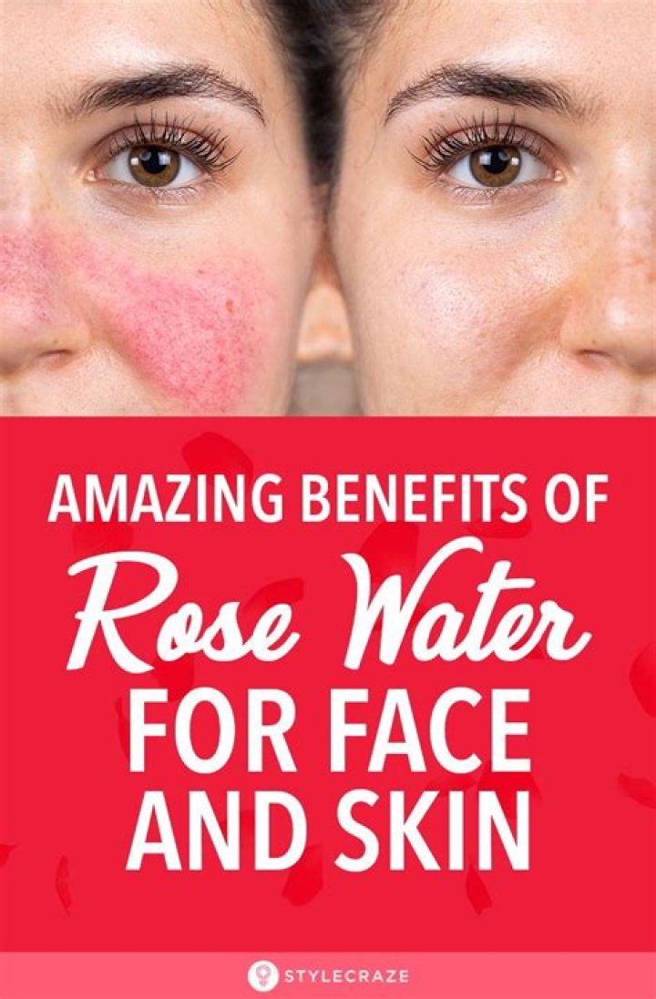 Is Rosewater good for acne?