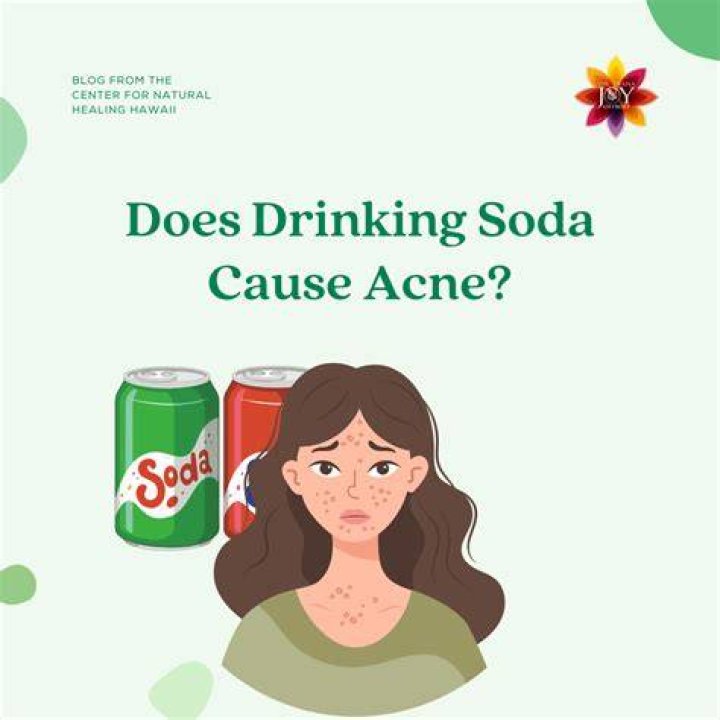 Is soda bad for acne?