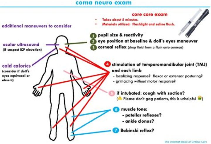 Is stupor a coma?
