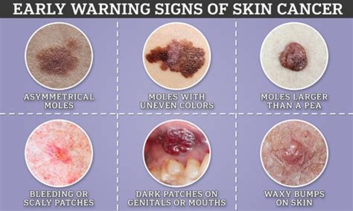 Is tapioca cancerous?