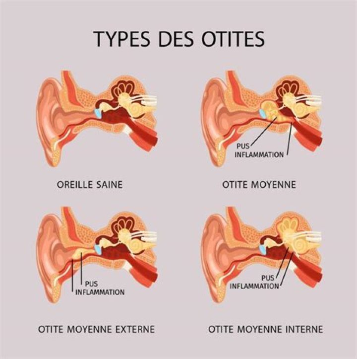 Qu’est-ce qui empêche l’absorption du magnésium ?