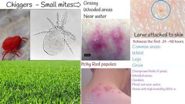 What can I use to kill chiggers?