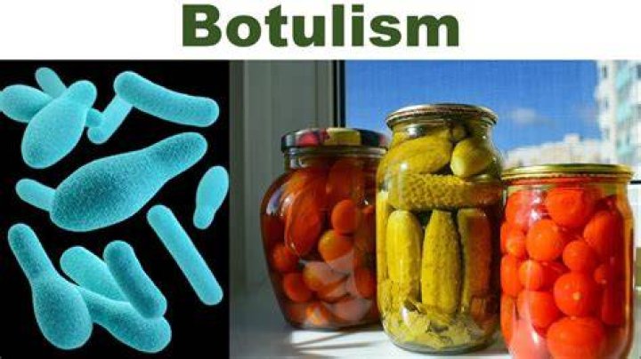 What does a can with botulism look like?