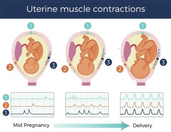 What does an intense contraction feel like?