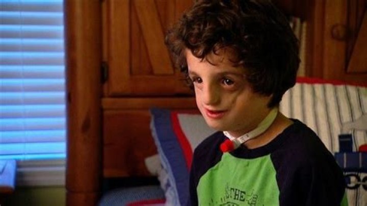 What does Auggie look like in the book wonder?