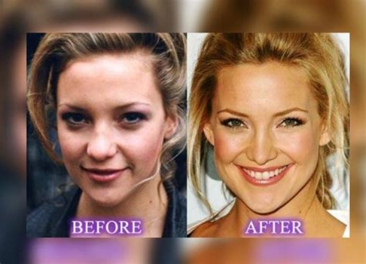 What does Kate Hudson do now?