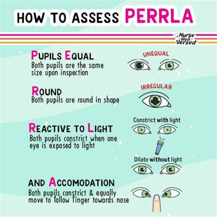 What does Perrla stand for and how do I assess for it?