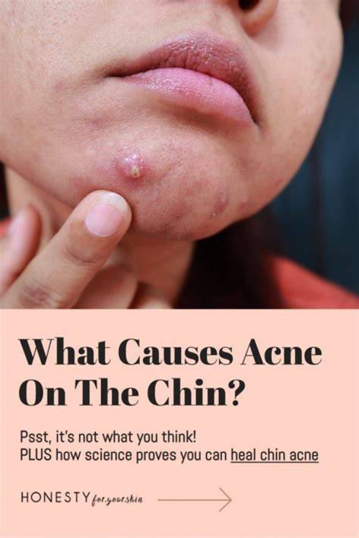 What does toast Chin Chin mean?