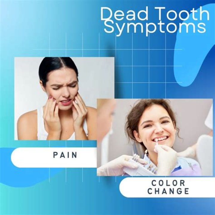 What happens if you leave a dead tooth in your mouth?