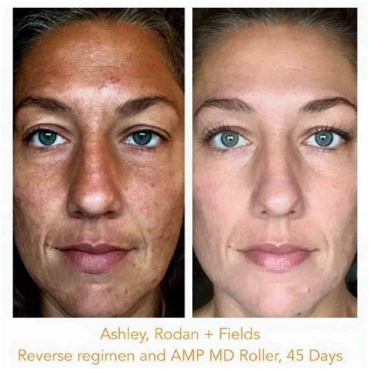 What percentage of retinol is in Rodan and Fields Reverse?