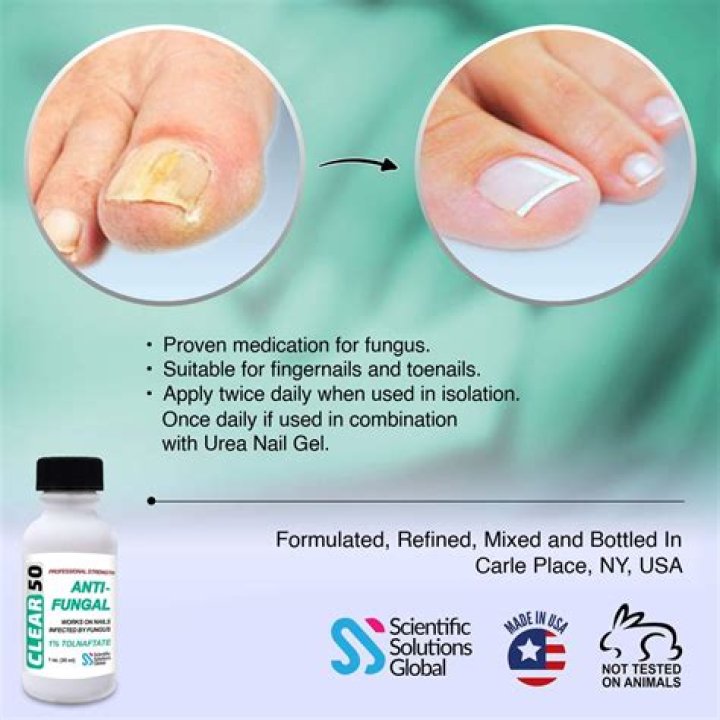 What prescription medication is used for toenail fungus?
