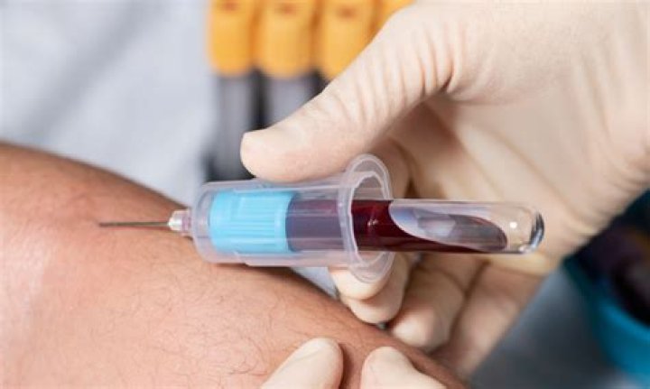 What size needle is used for drawing blood?