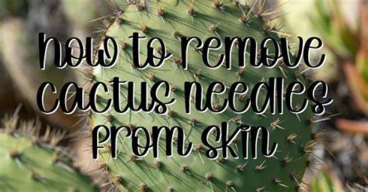 Will cactus needles come out on their own?
